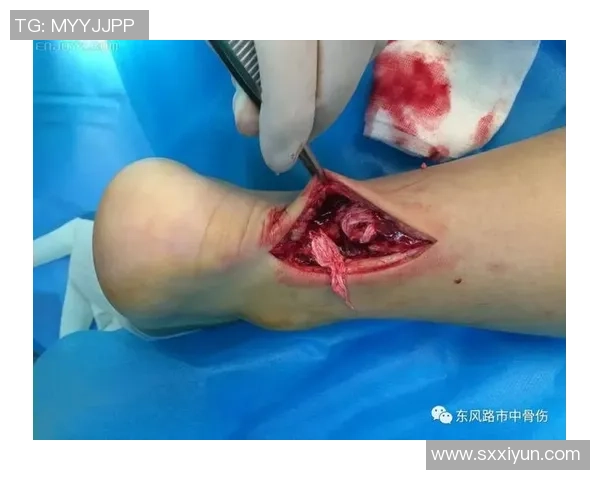 踢足球时如何保护肌腱避免受伤的有效方法与注意事项